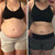 Resultados visibles de reducción de abdomen y medidas con Redu Sculpt