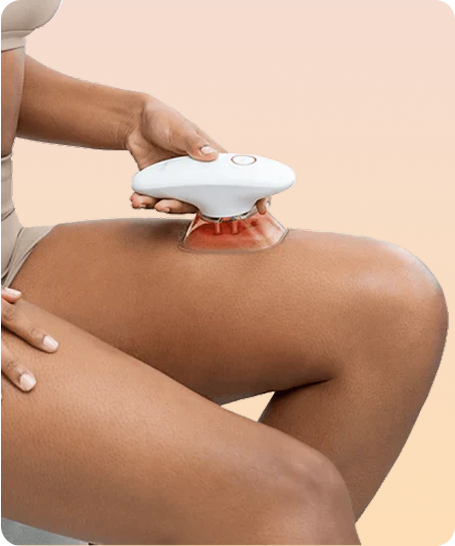 Dispositivo Redu Sculpt aplicado en los muslos para reducir celulitis y estilizar piernas