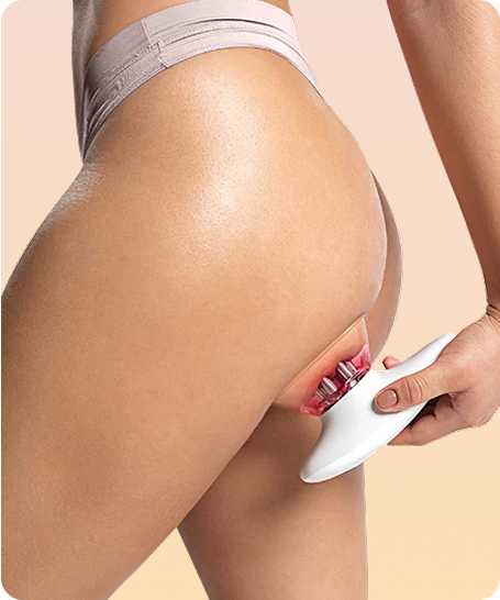 Uso de Redu Sculpt en los glúteos para mejorar la firmeza y reducir celulitis